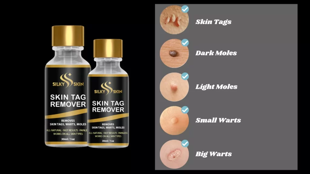 Silky-Skin-Tag-Remover-Serum